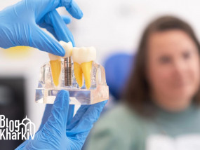 Протезування зубів в Харкові: про незнімні зубні протези